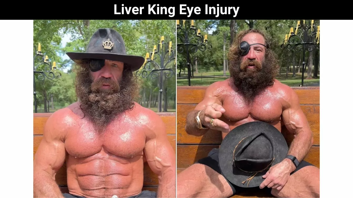 Liver King Eye Injury Update